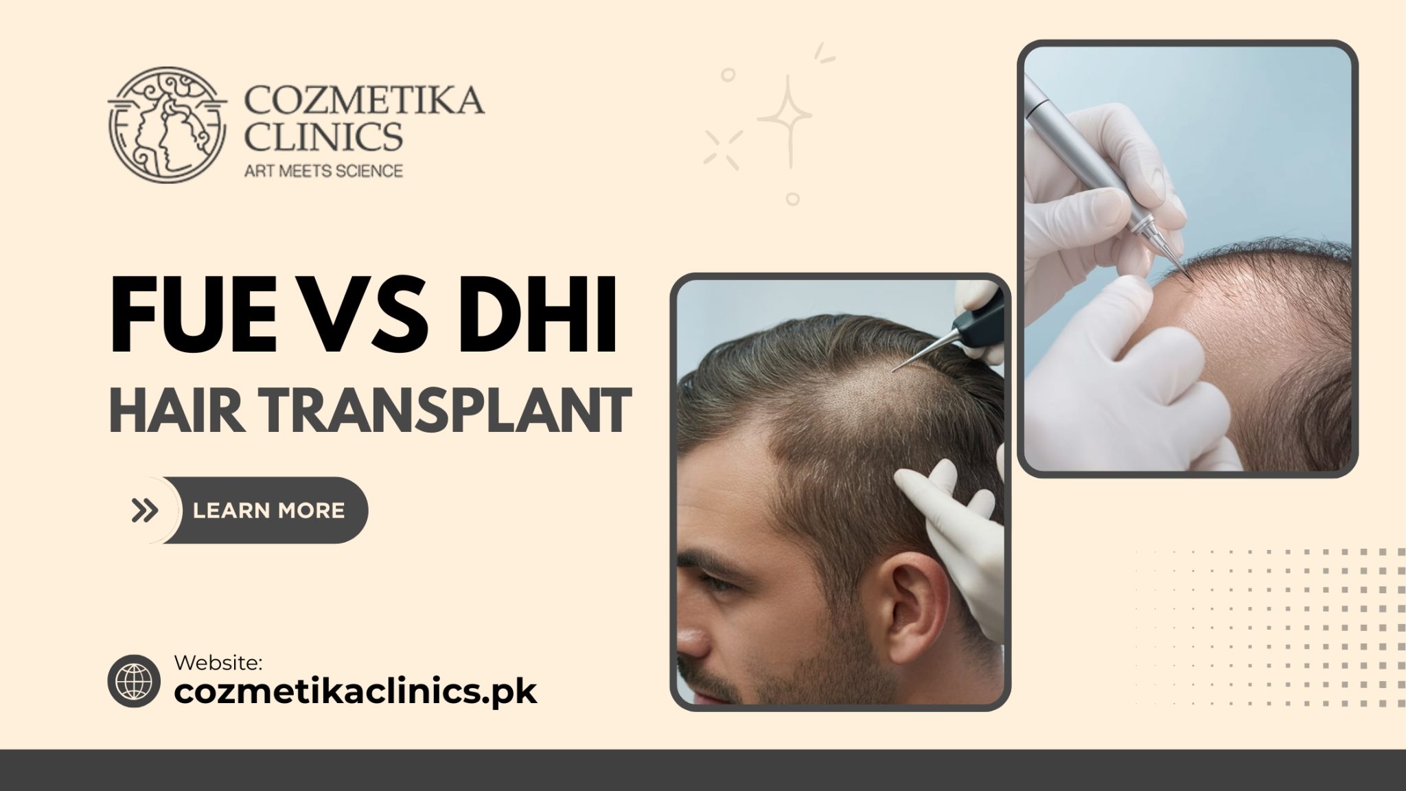 Dhioff FUE vs DHI: Which One Is Right for You? - Cozmetika Clinics