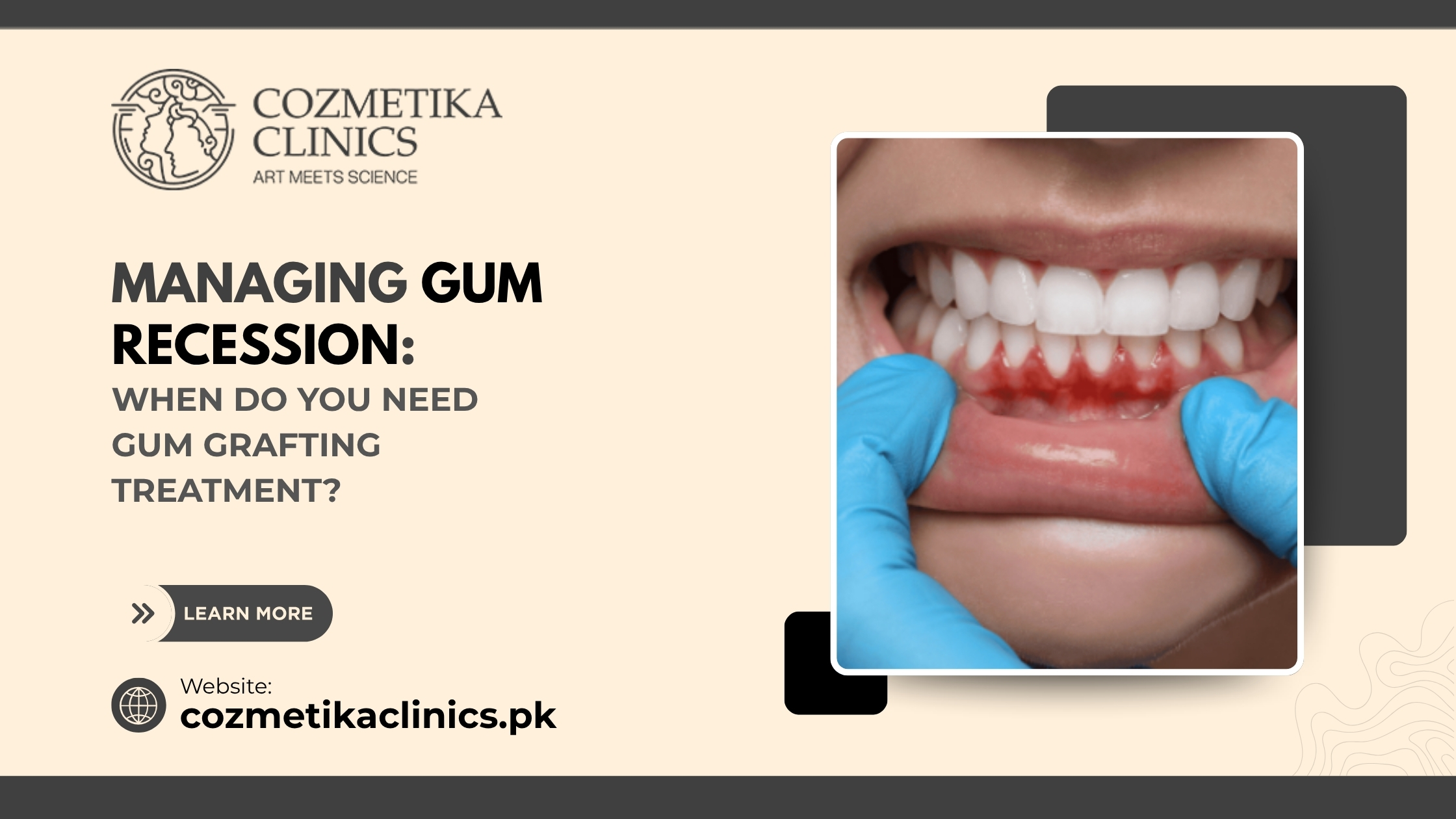 Face laser in islamabad